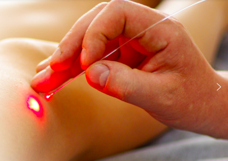 Lazer ve RF Tedavisi