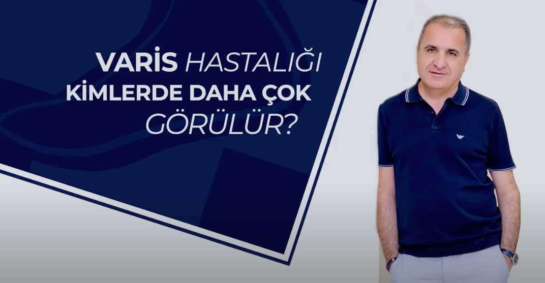 VARİS HASTALIĞI KİMLERDE DAHA ÇOK GÖRÜLÜR?