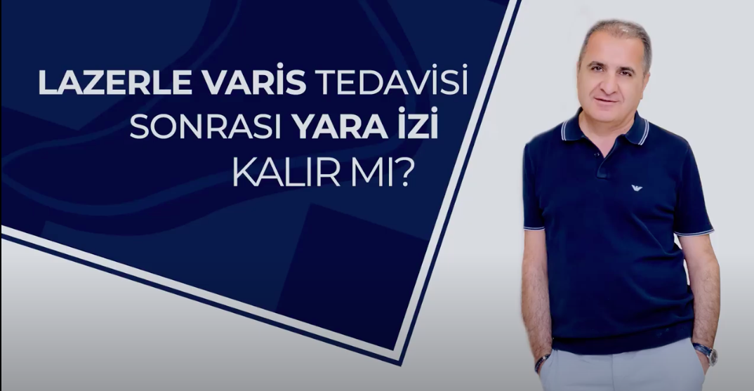 Lazerle Varis Tedavisi Sonrası Yara İzi Kalır Mı?