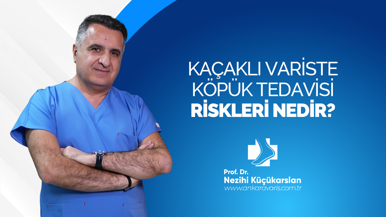 KAÇAKLI VARİSTE KÖPÜK TEDAVİSİ RİSKLERİ NEDİR?